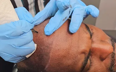 SMP Barber /Scalp Micropigmentation